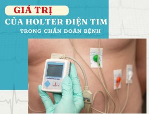 Giá trị của Holter điện tim trong chẩn đoán bệnh