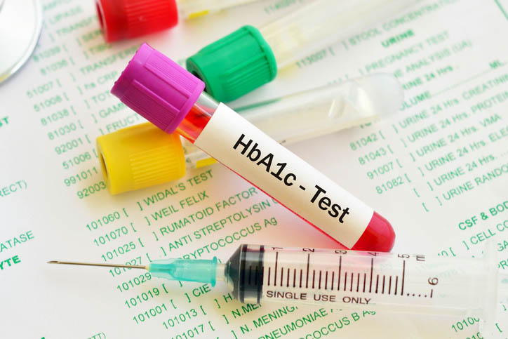 Ống nghiệm để làm xét nghiệm HbA1c tại các cơ sở y tế