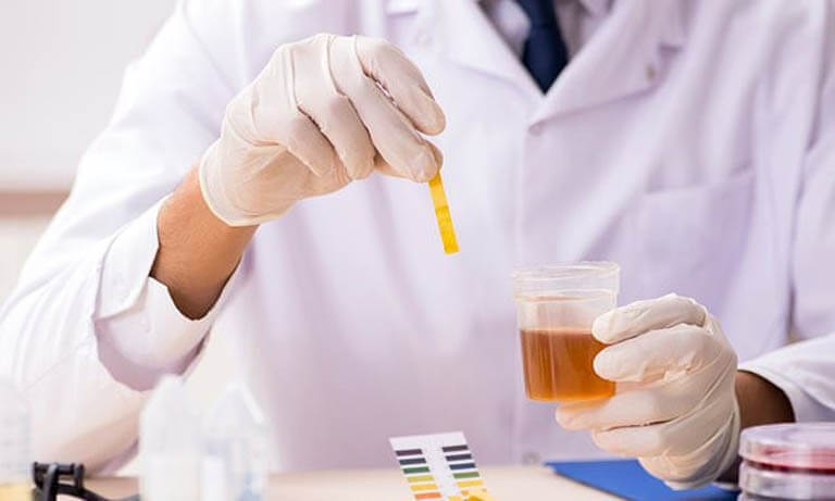 Phương pháp xét nghiệm nước tiểu sử dụng que test